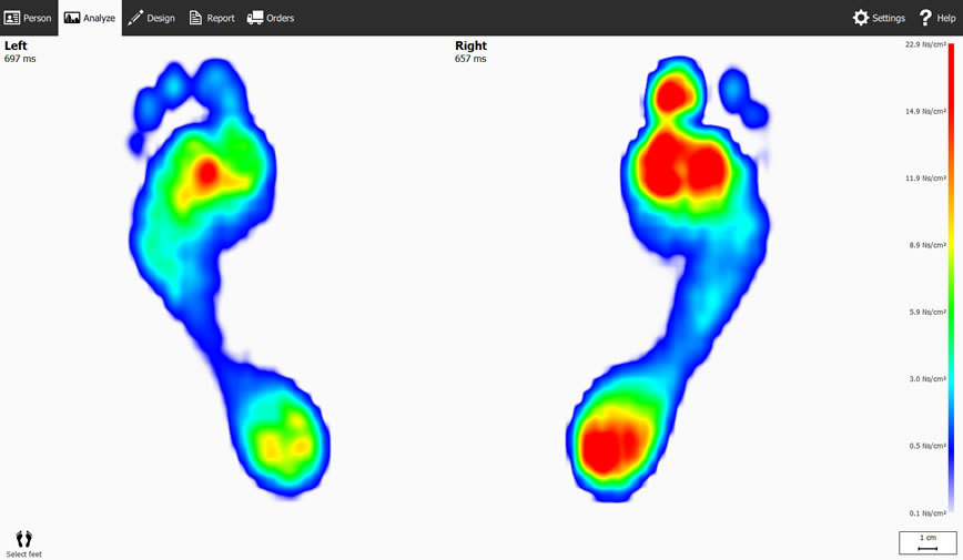 diabetic foot assessment 